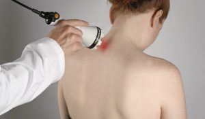 Laser Therapy at Complete Connection Chiropractic in Ames, Iowa